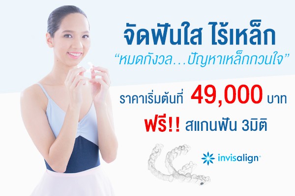 ราคา การจัดฟันแบบใส Invisalign